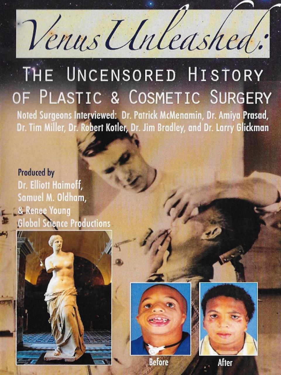 Venus Unleashed: The Uncensored History of Plastic & Cosmetic Surgery